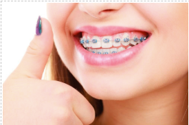 Brackets Metalicos